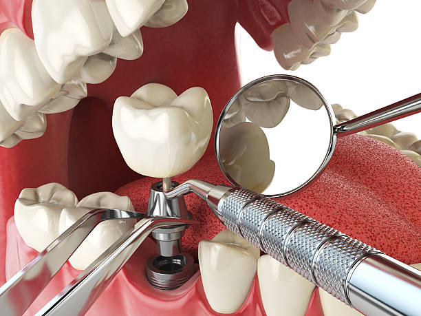 Best Cracked Tooth Emergency Dentist  in Lookout Mountain, AL
